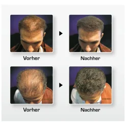 Biothik Haaraufbau-Faser S9 rotbraun 15 g