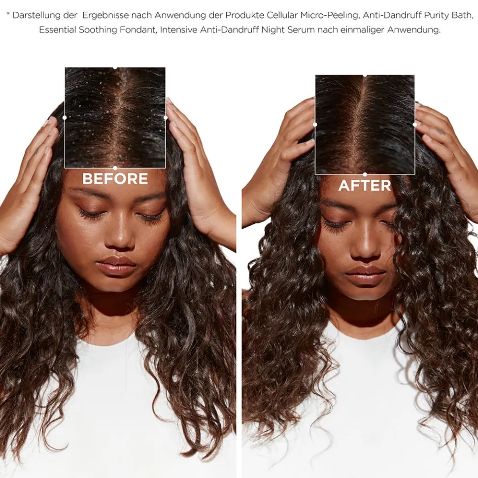 Kérastase Symbiose Bain Crème Anti-Pelliculaire 250 ml