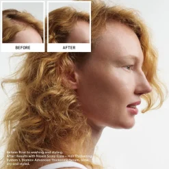 Nioxin Scalp + Hair System 1 Shampoo 300 ml