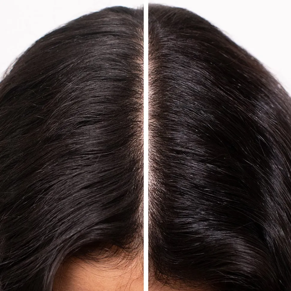 Shu Uemura Essence Absolue Kopfhautkonzentrat 50 ml