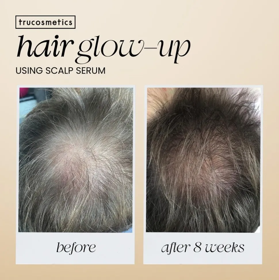 Trucosmetics Hair Growth Serum 50 ml