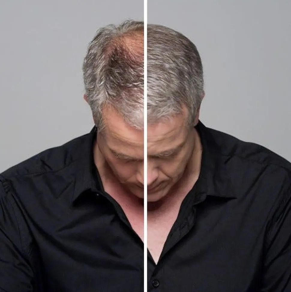 Volume Hair Fix 100 ml