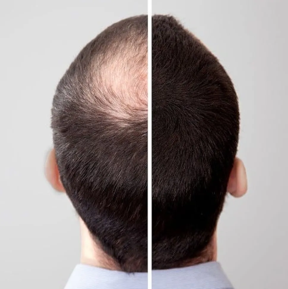 Volume Hair Fix 100 ml